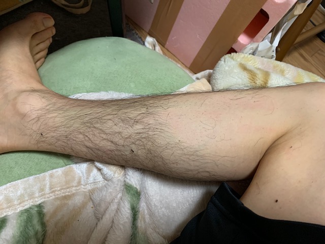 足を脱毛してみた