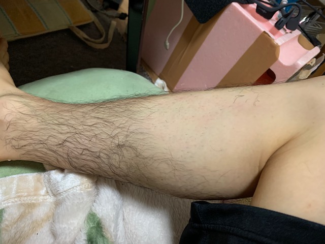 足を脱毛してみた